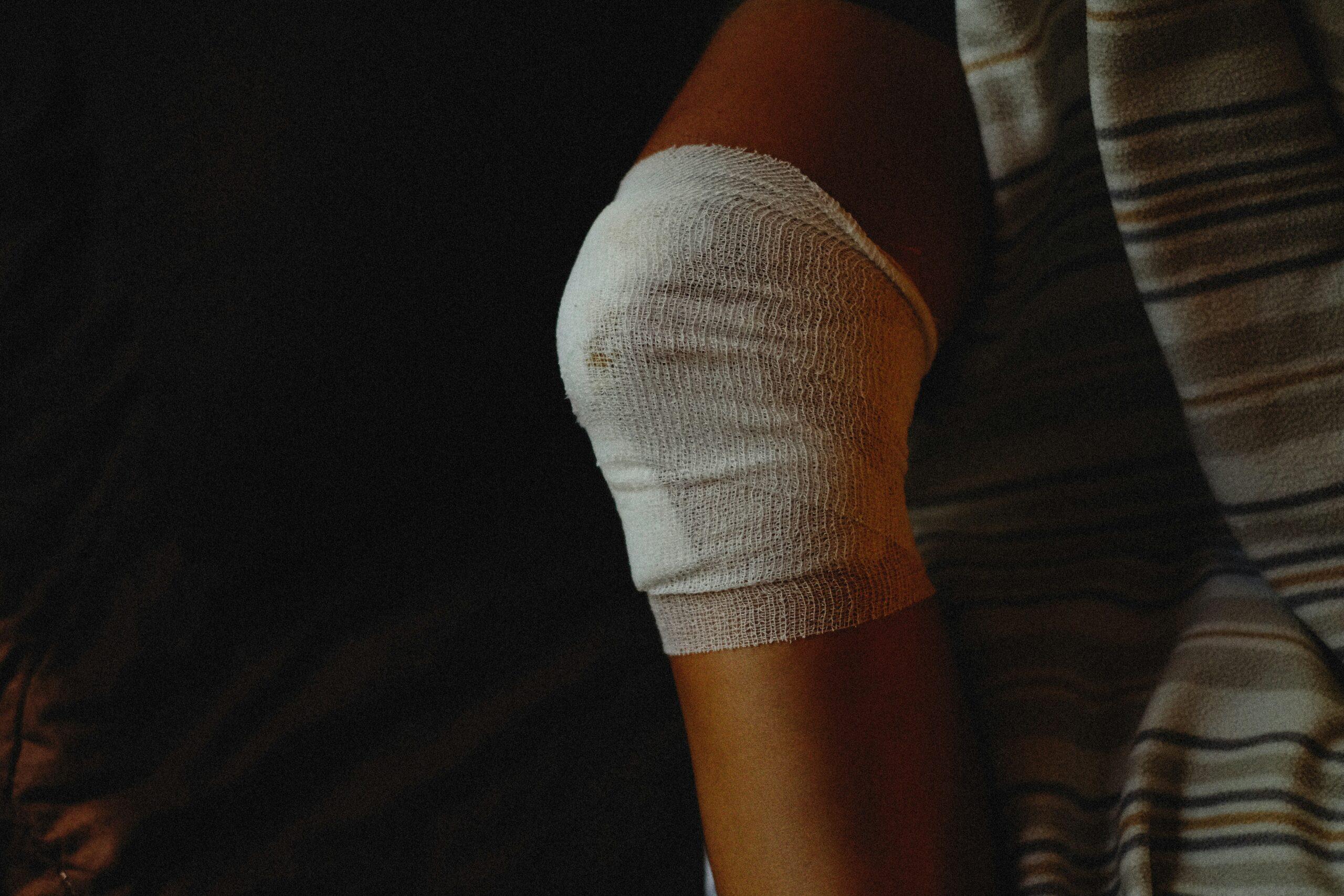 A close-up of a person’s knee wrapped in white medical bandages, resting on a dark surface with a striped blanket partially visible beside the injured leg.